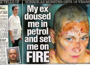 Louise sold her story to the Sun